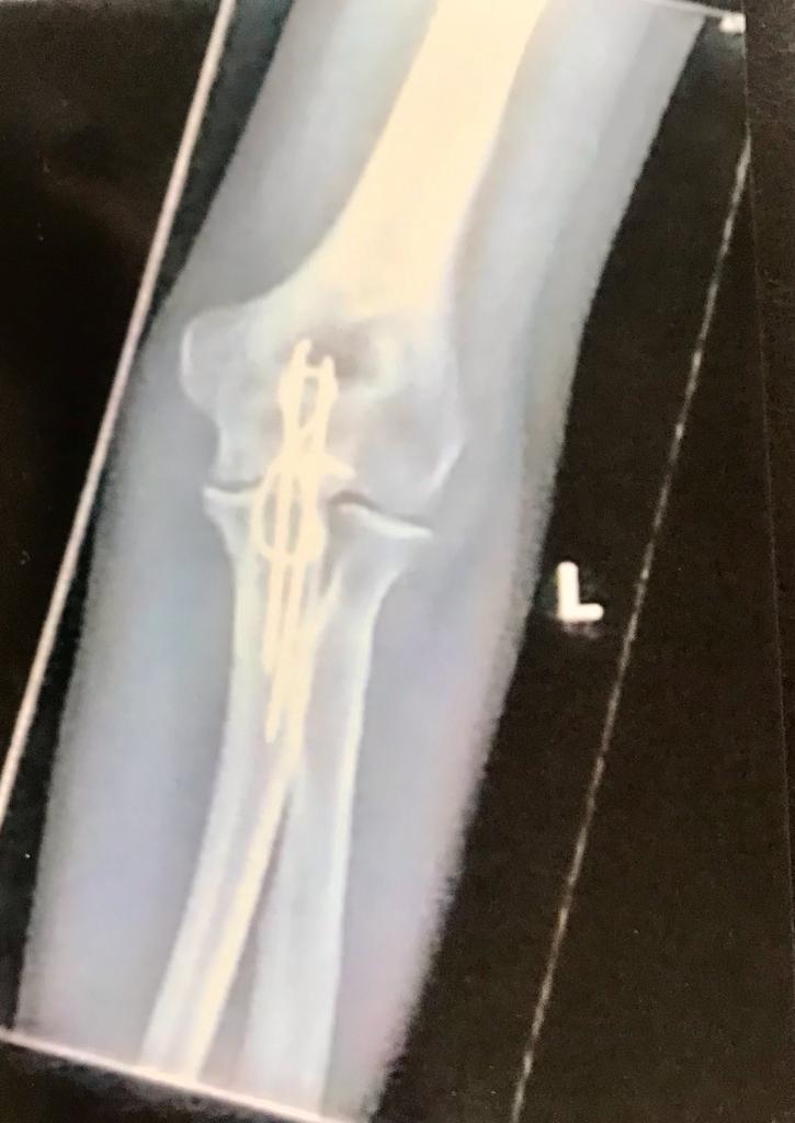 Flat Stanley in Australia Volume II by Jane Cohen - Illustrated by John Carroll Jnr - Ourboox.com